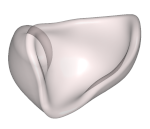 Semi-Schale Otoplastik